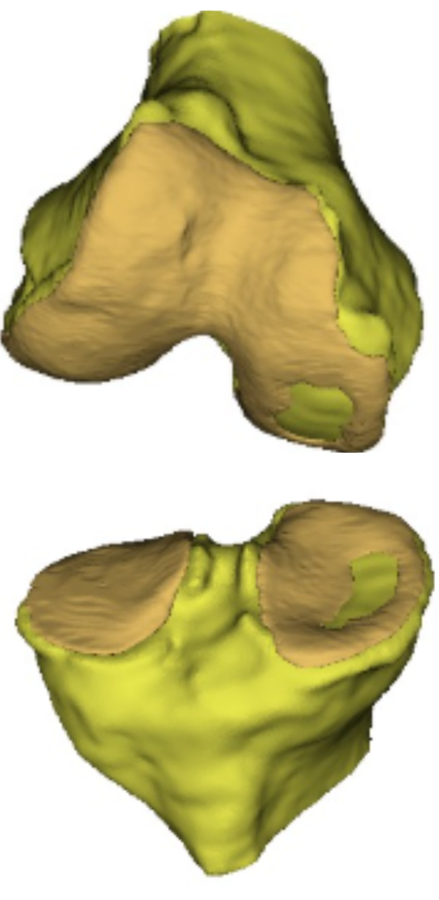 STL Model